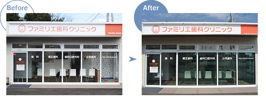 ファミリエ歯科クリニックのBeforeAfter